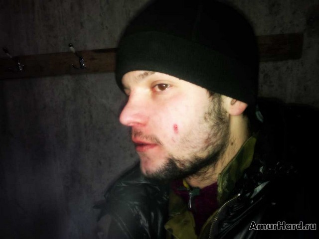 пуля в щеке
